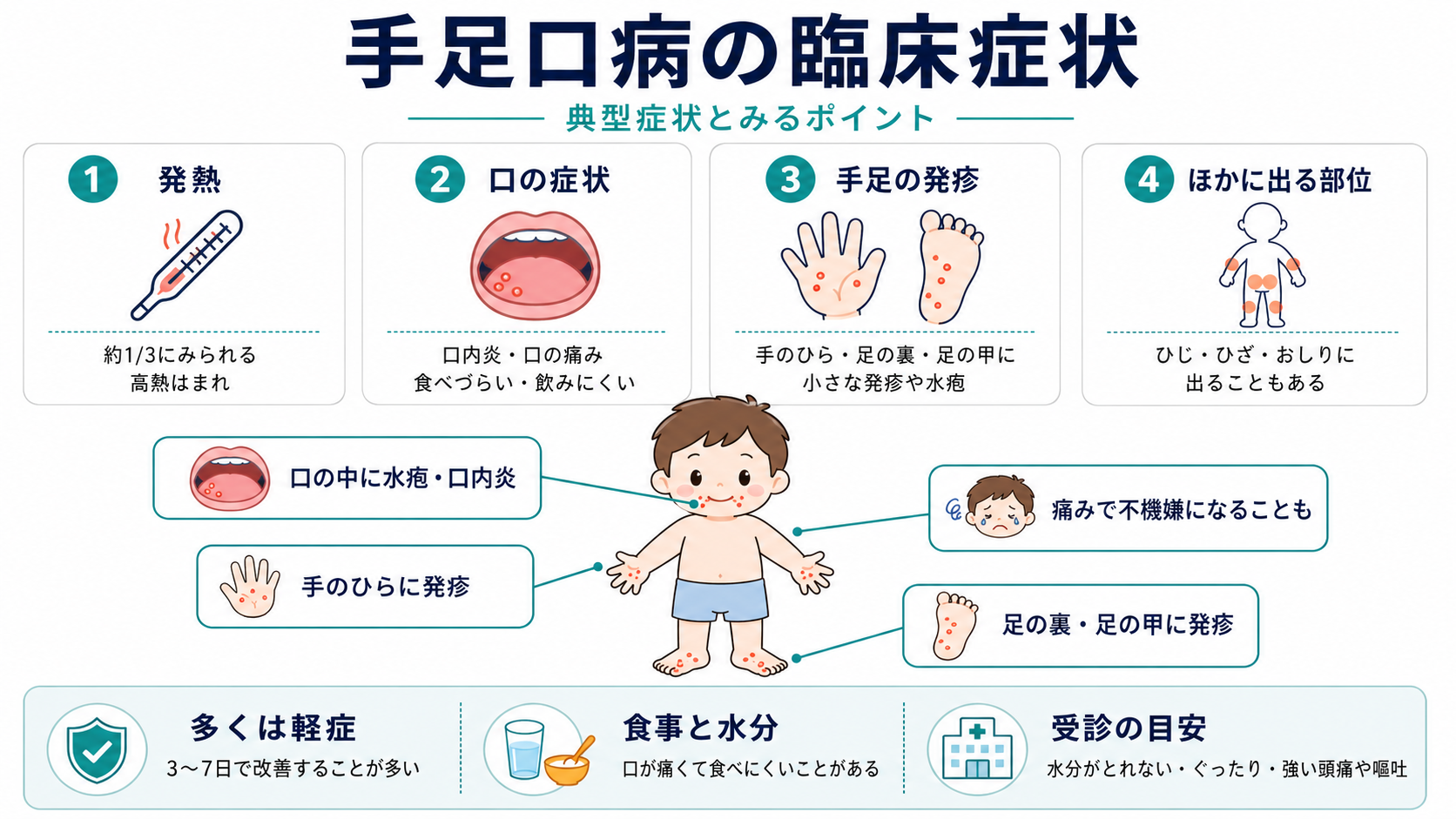 手足口病の臨床症状（典型症状とみるポイント）：①発熱は約1/3にみられ高熱はまれ／②口の症状は口内炎・口の痛み・食べづらい飲みにくい／③手足の発疹は手のひら・足の裏・足の甲に小さな発疹や水疱／④ほかに出る部位はひじ・ひざ・おしり。多くは軽症で3〜7日で改善、口が痛くて食べにくいことがある。受診の目安は水分がとれない・ぐったり・強い頭痛や嘔吐